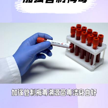 加强管制梅毒溯源菌毒洁身自好